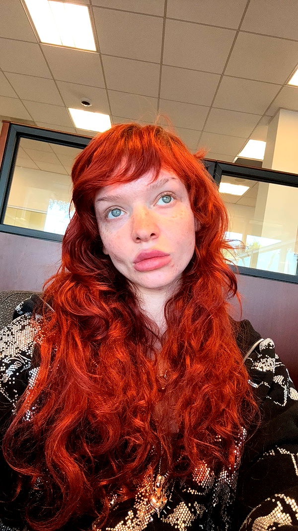 endangerdreamer image ~ Altpins