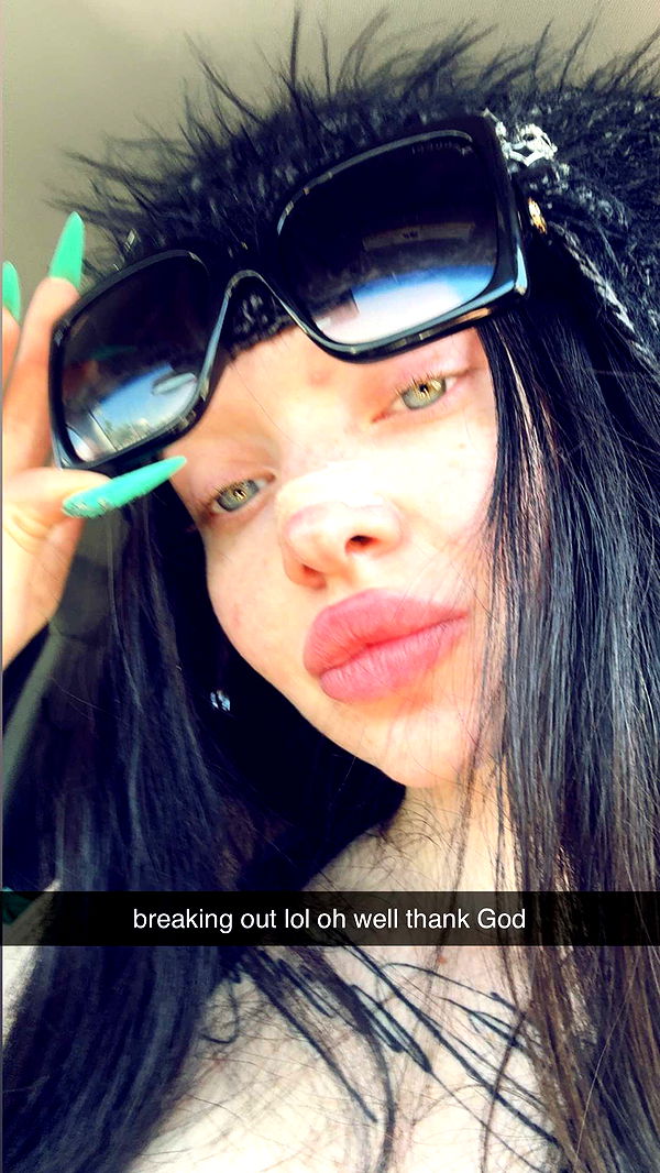 endangerdreamer image ~ Altpins