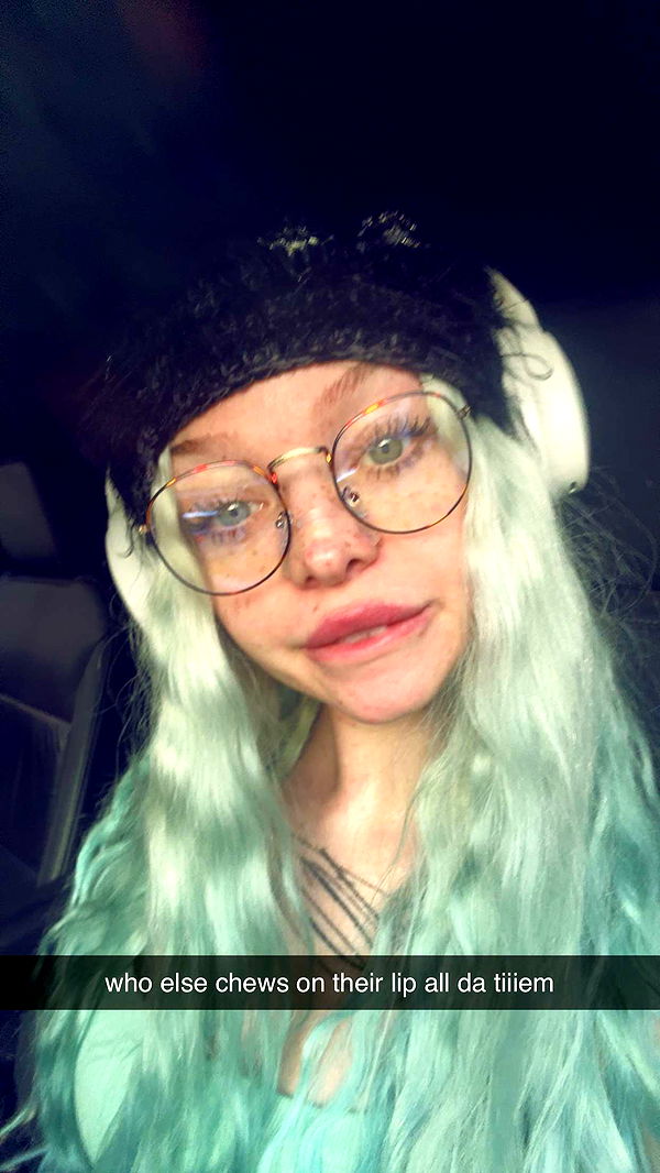 endangerdreamer image ~ Altpins