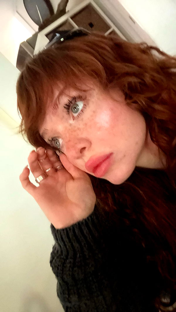 endangerdreamer image ~ Altpins