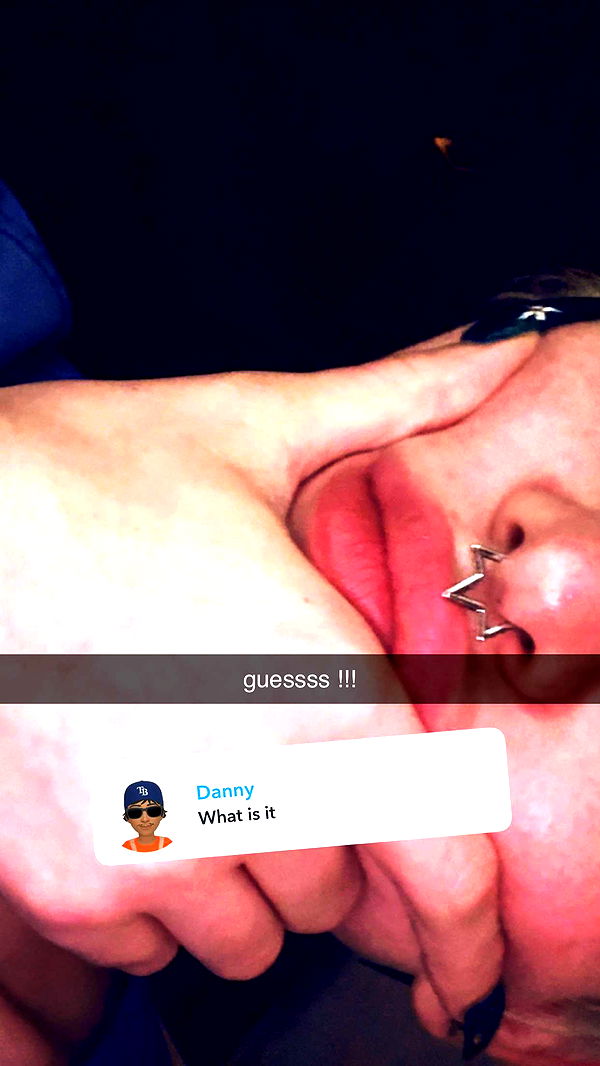 endangerdreamer image ~ Altpins