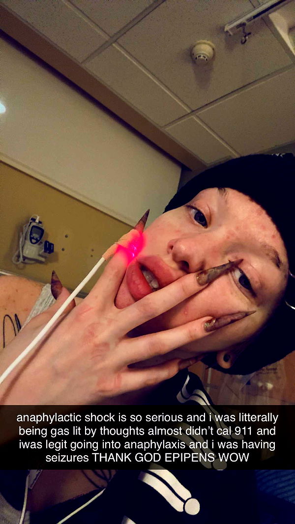 endangerdreamer image ~ Altpins