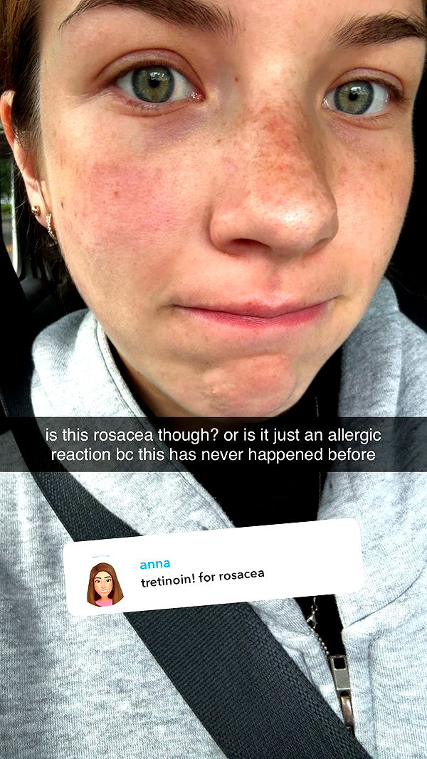 fionamaefit image ~ Altpins