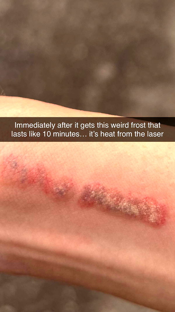 imchloebleu snapchat image archive image