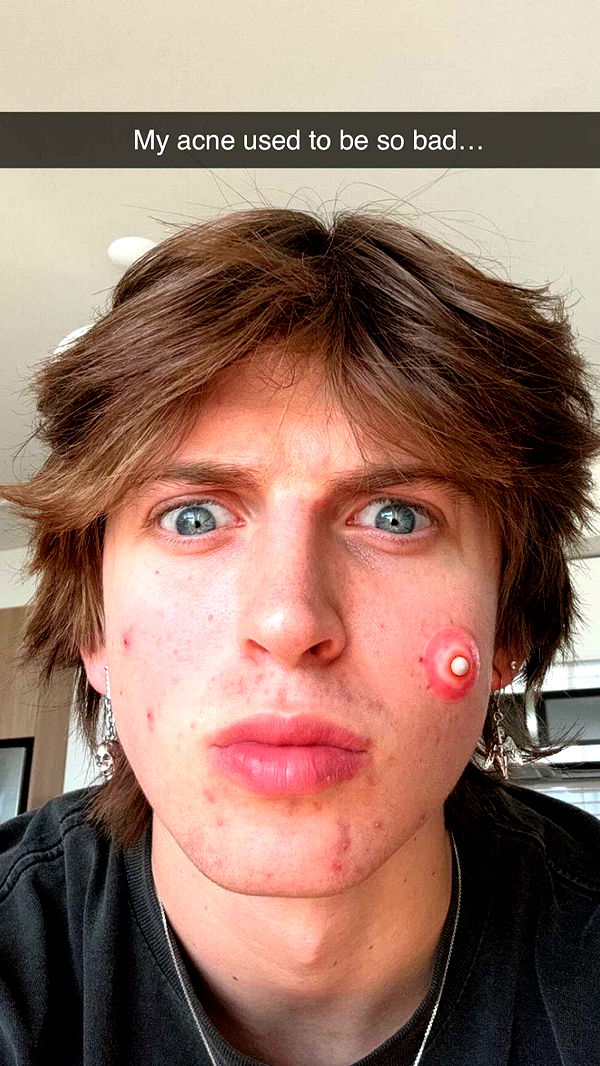 jacobxday image ~ Altpins