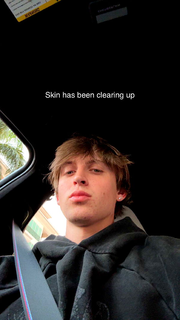 jacobxday image ~ Altpins