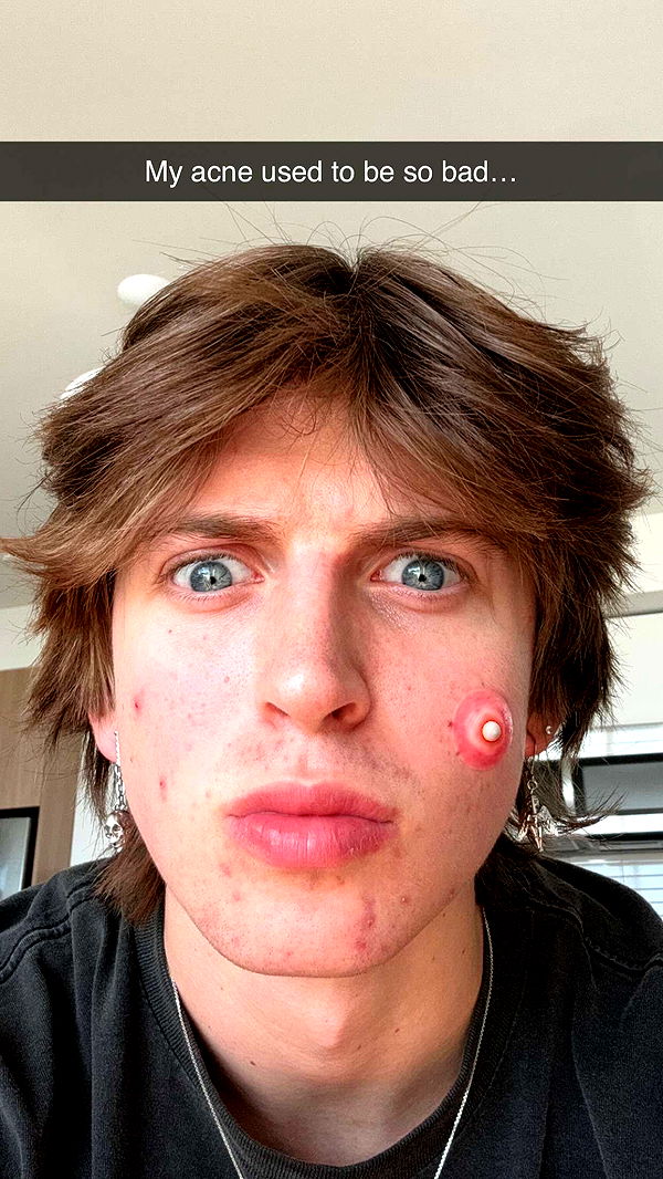 jacobxday image ~ Altpins