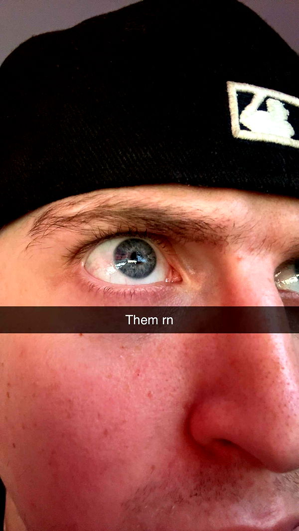 jacobxday image ~ Altpins