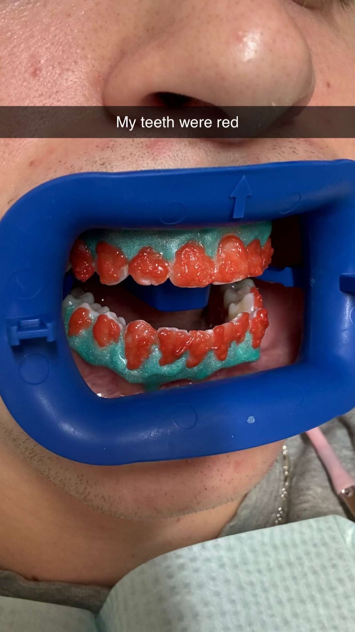 jacobxday snapchat image archive image