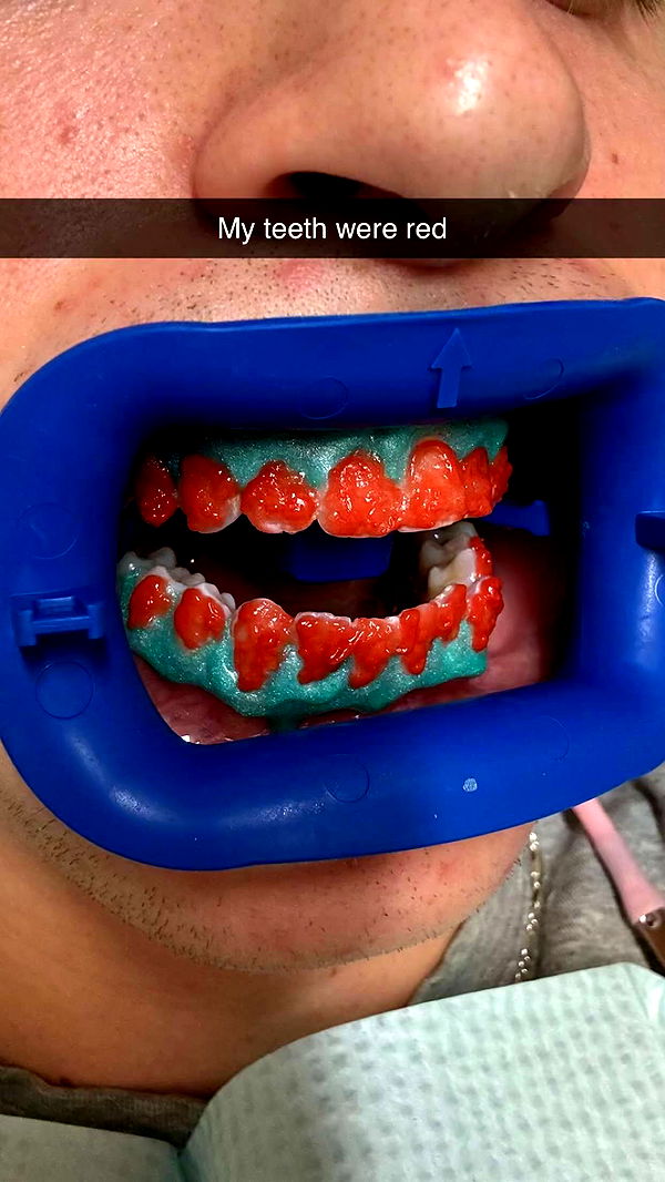 jacobxday image ~ Altpins