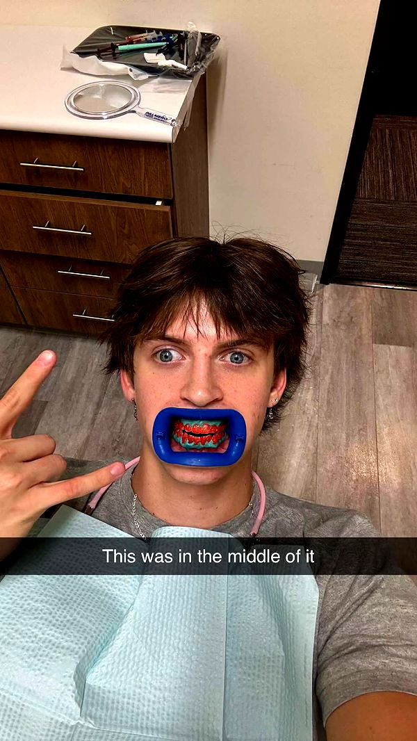 jacobxday image ~ Altpins