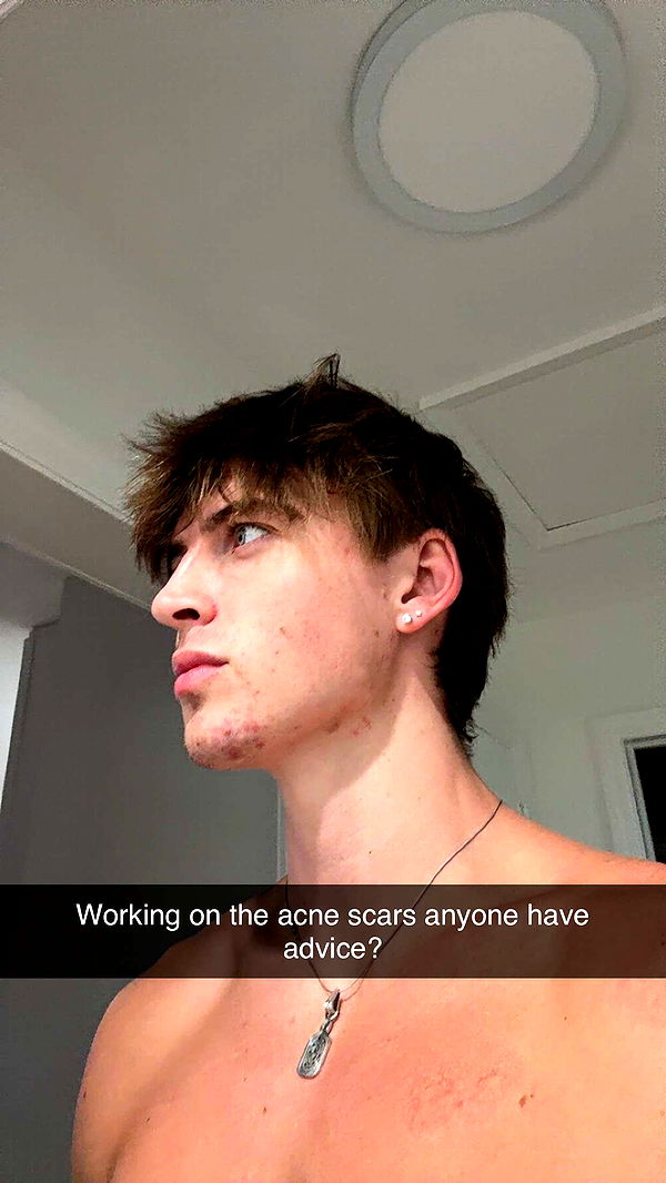 jacobxday image ~ Altpins