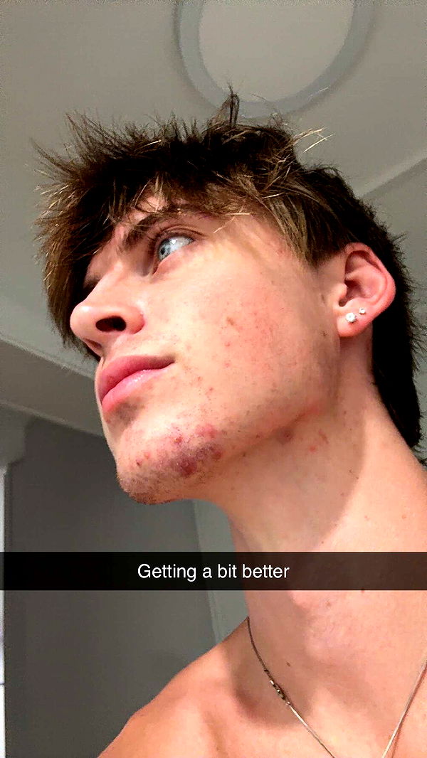 jacobxday image ~ Altpins