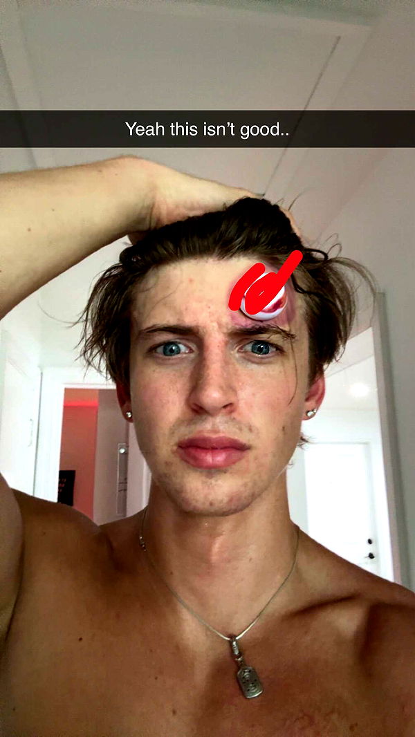 jacobxday image ~ Altpins