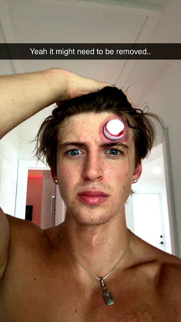 jacobxday image ~ Altpins