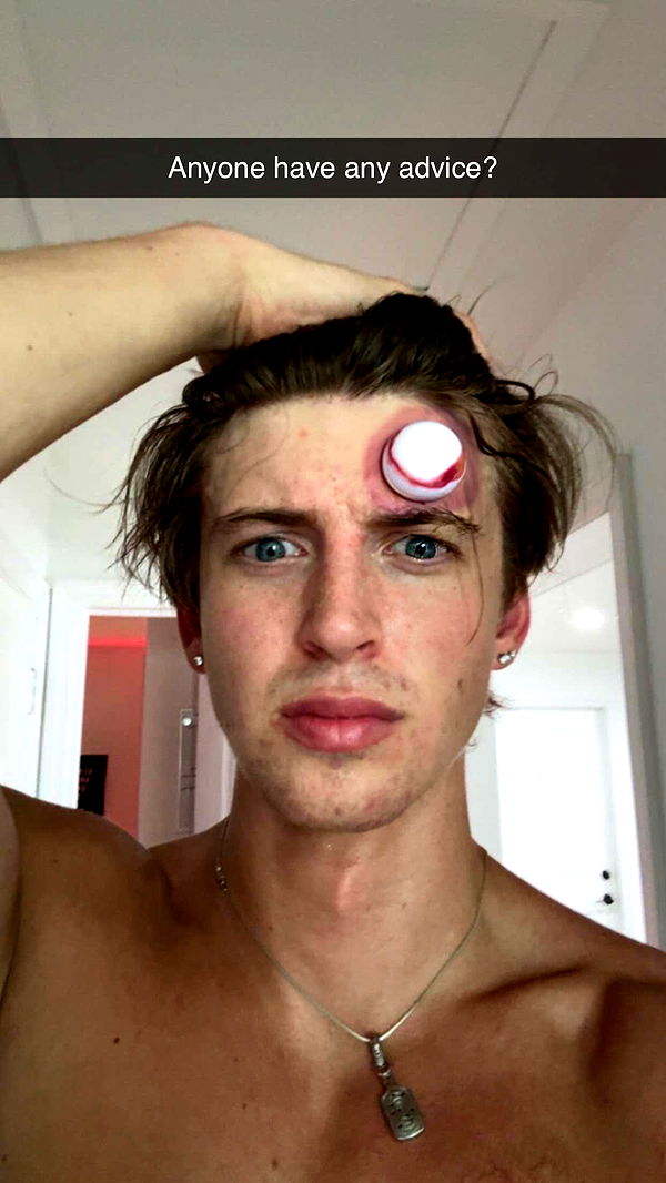 jacobxday image ~ Altpins