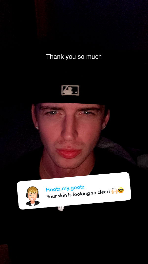 jacobxday image ~ Altpins