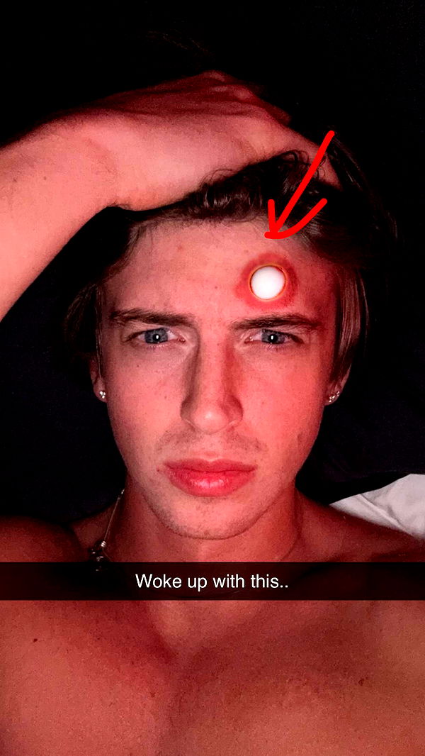 jacobxday image ~ Altpins