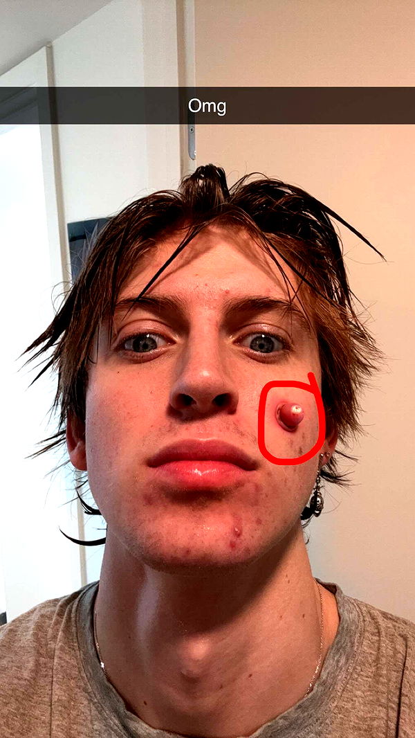 jacobxday image ~ Altpins