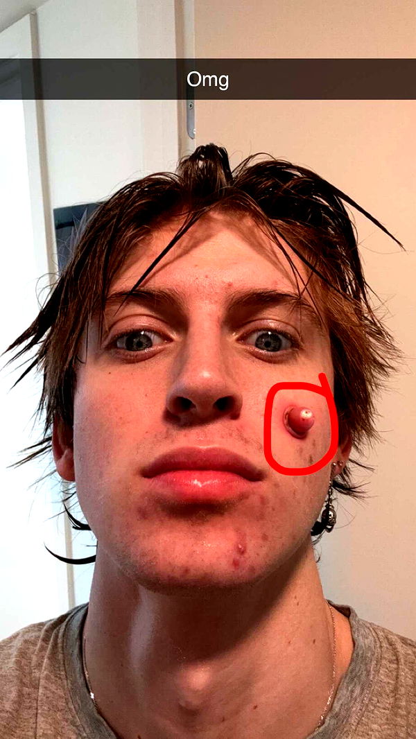 jacobxday image ~ Altpins