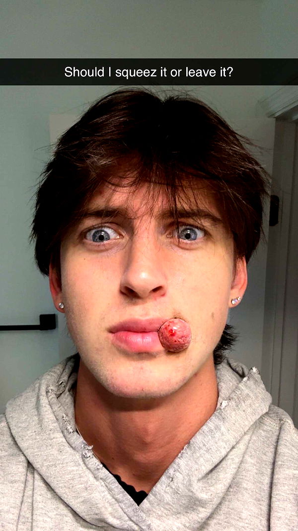 jacobxday image ~ Altpins