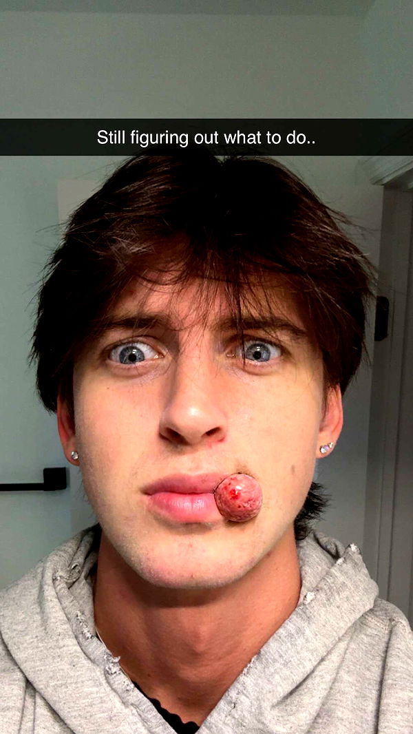 jacobxday image ~ Altpins