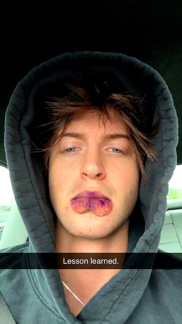 jacobxday image ~ Altpins