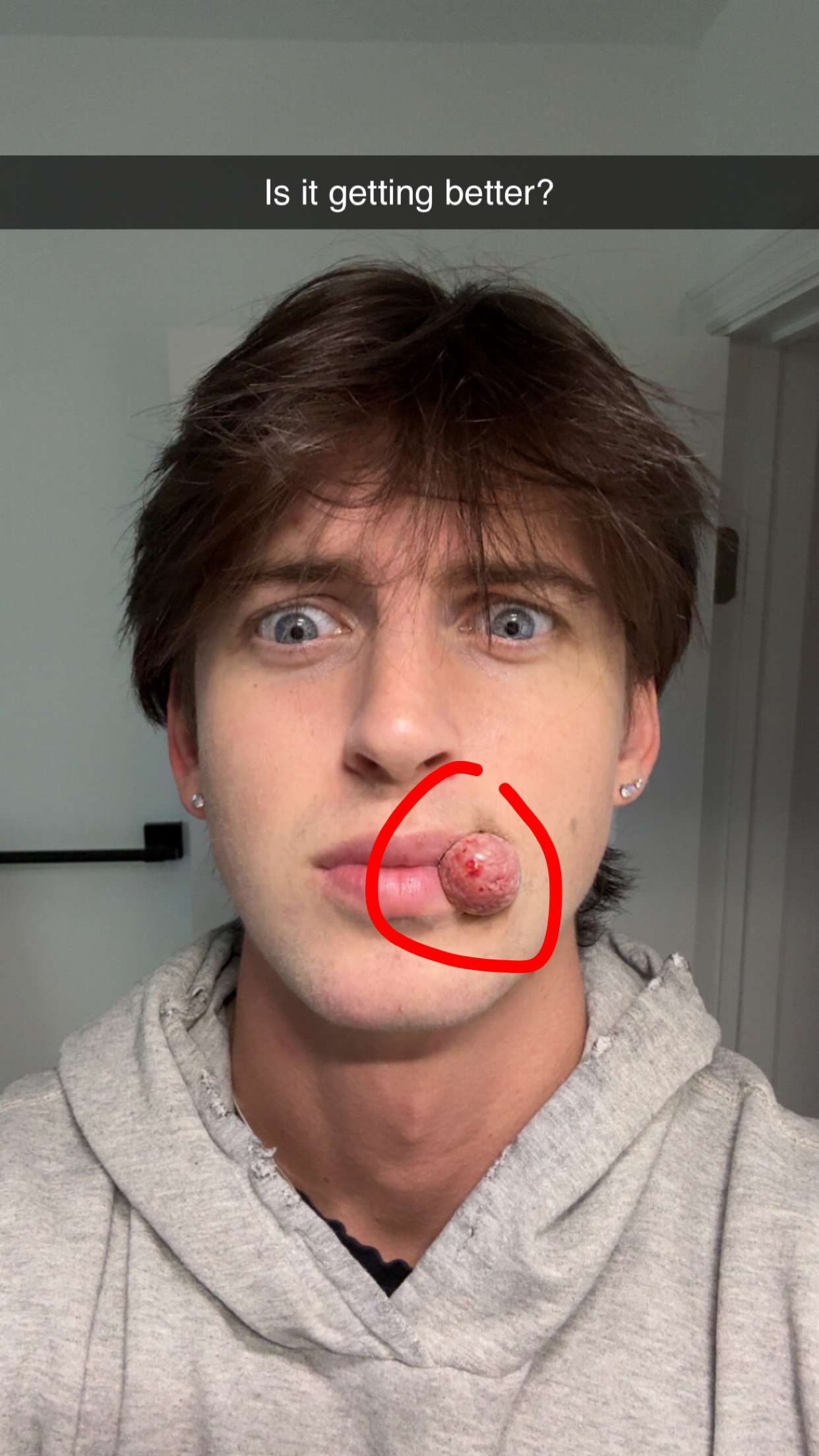 jacobxday snapchat image archive image