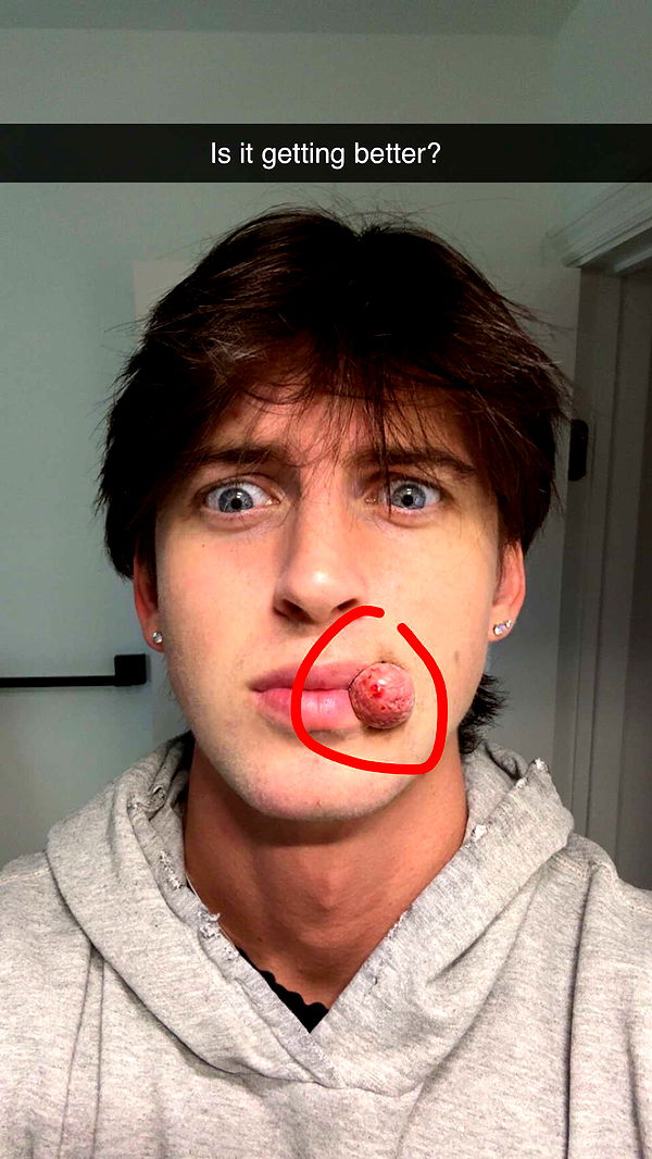 jacobxday image ~ Altpins