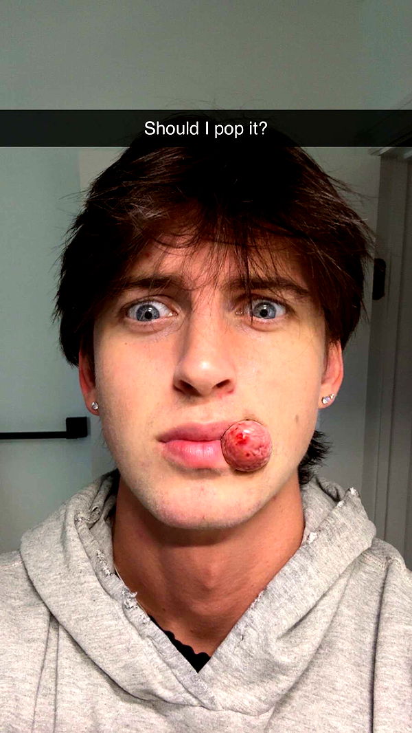 jacobxday image ~ Altpins