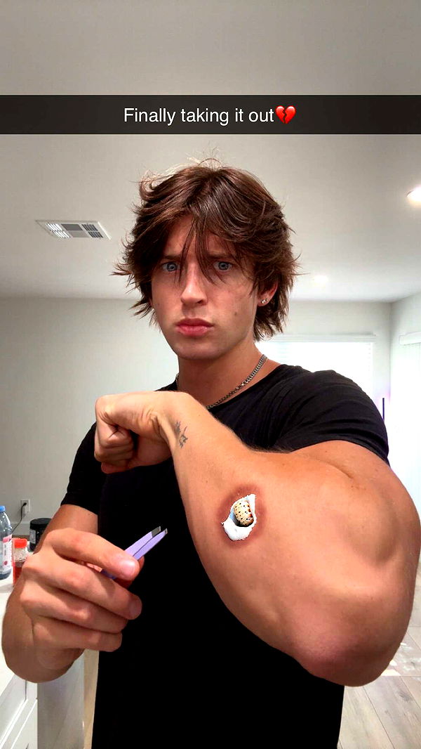 jacobxday image ~ Altpins