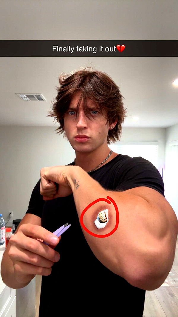 jacobxday image ~ Altpins