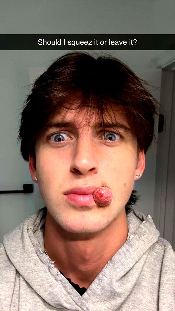 jacobxday image ~ Altpins