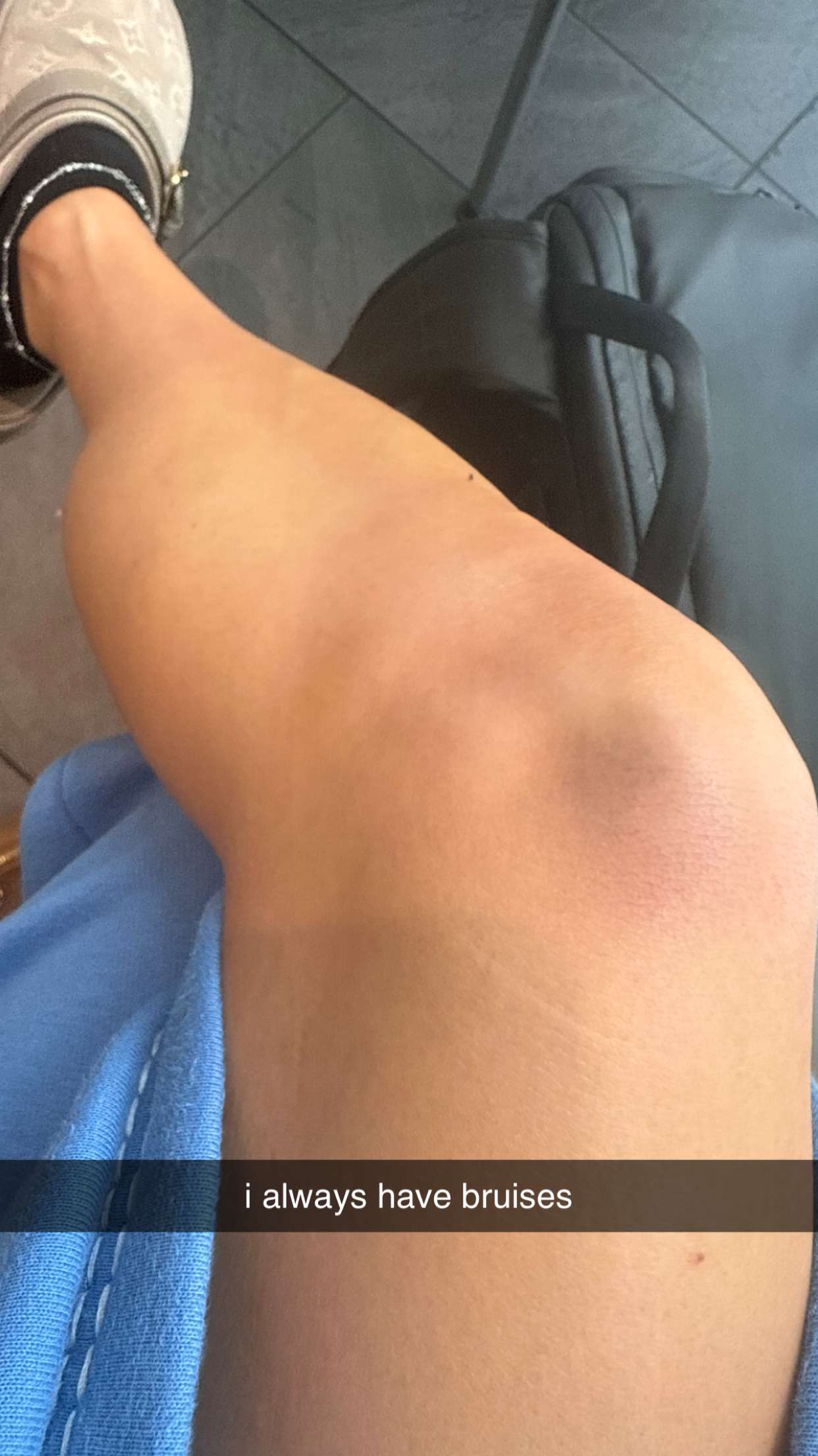 julia.filippo snapchat image archive image