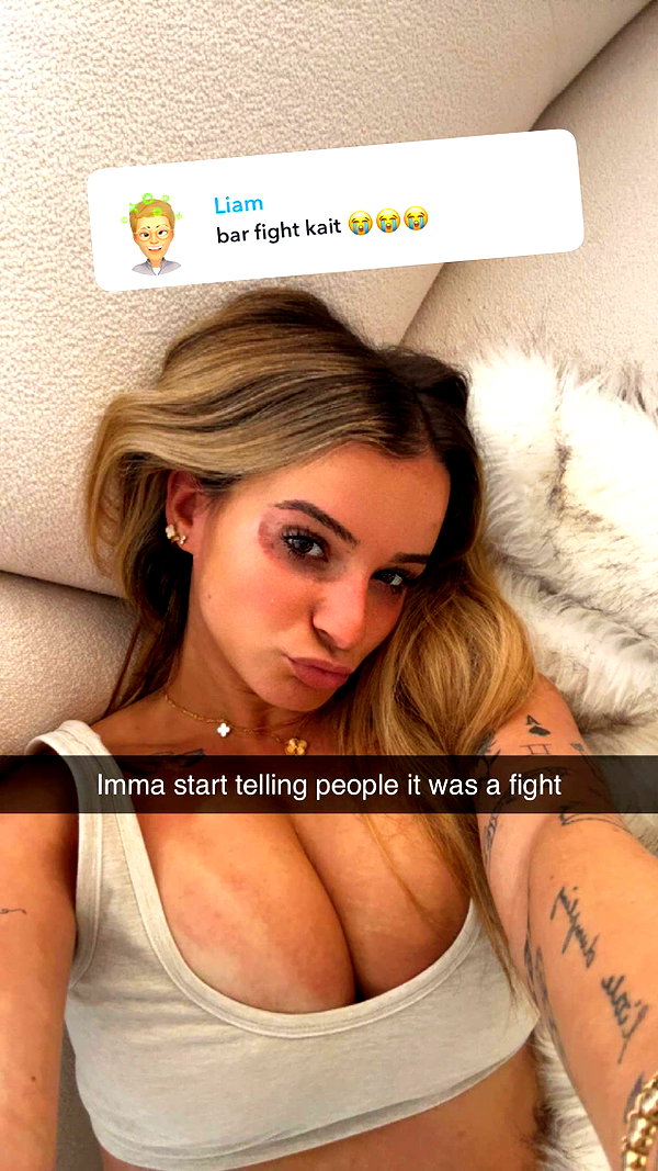kaitlyn_krems snapchat image archive image