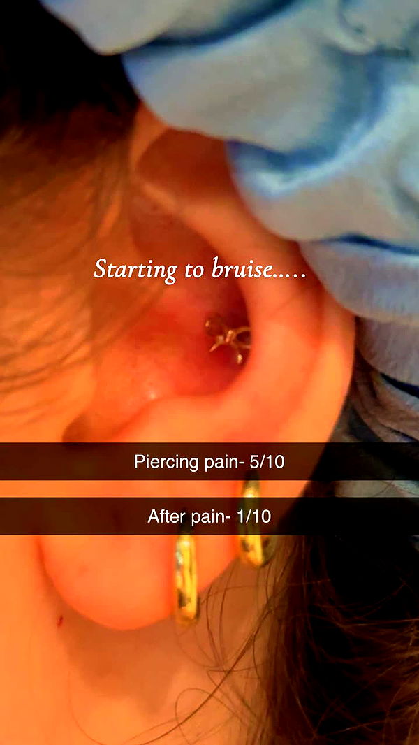 kalogeraseliana image ~ Altpins