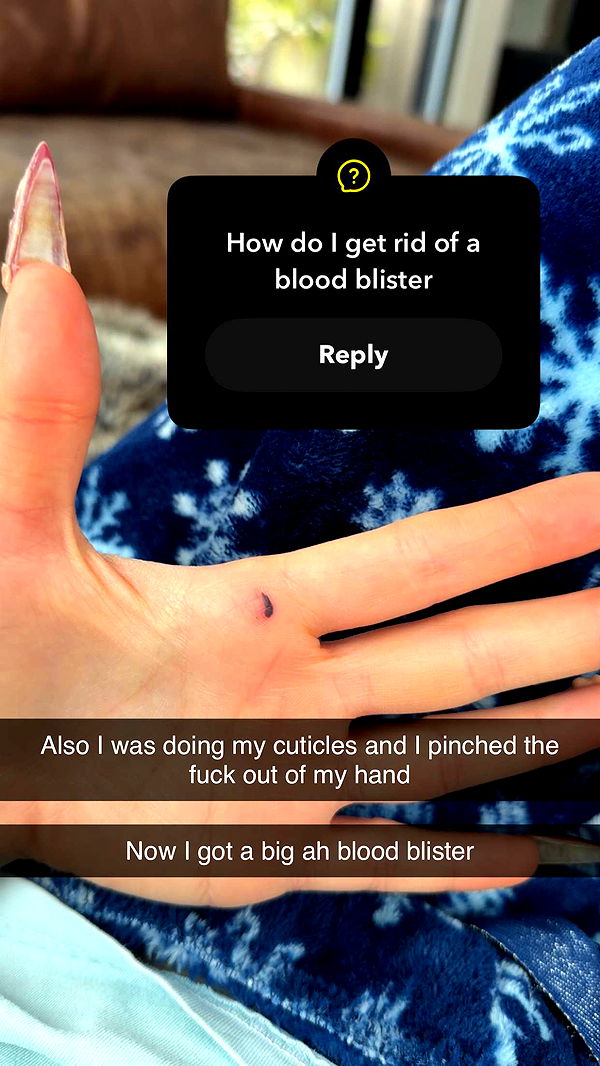 kalogeraseliana image ~ Altpins