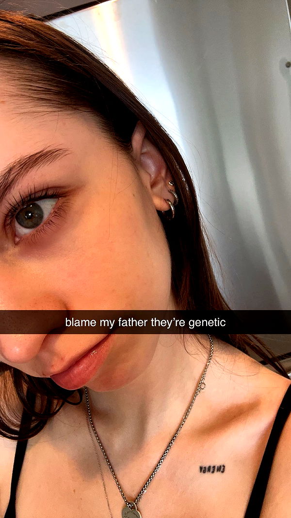 keab01 image ~ Altpins