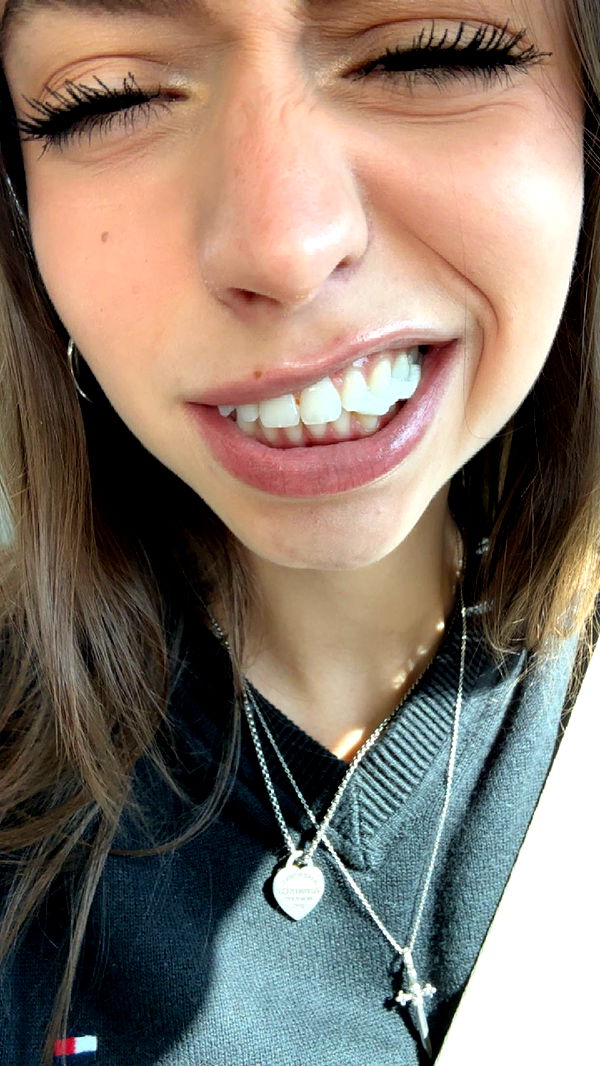 keab01 image ~ Altpins