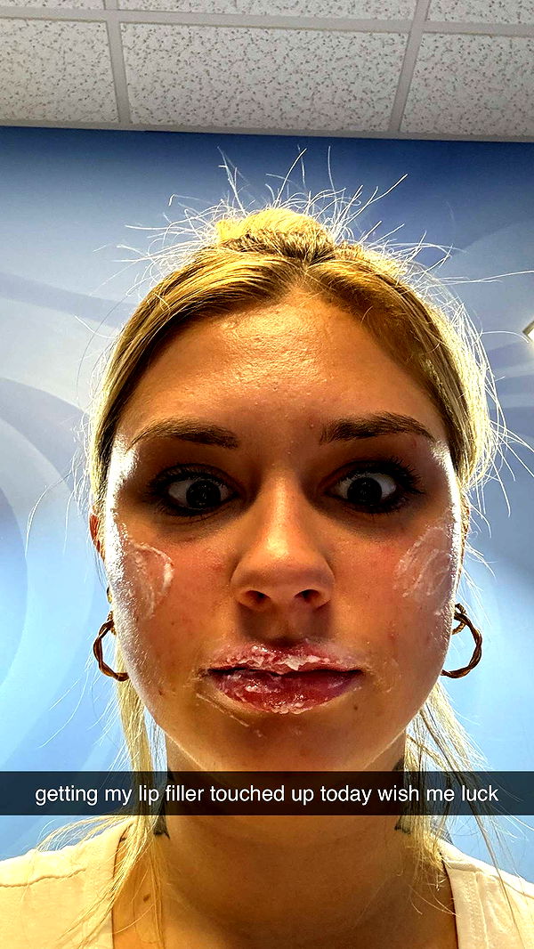 kkierstenking image ~ Altpins