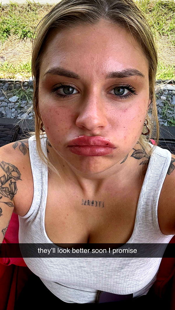 kkierstenking image ~ Altpins