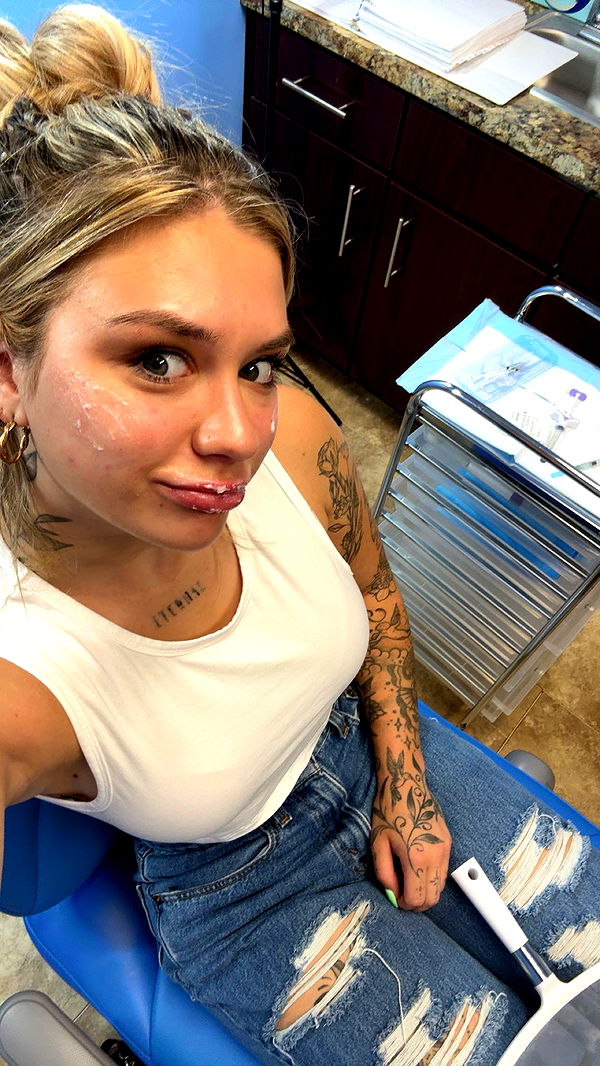 kkierstenking image ~ Altpins