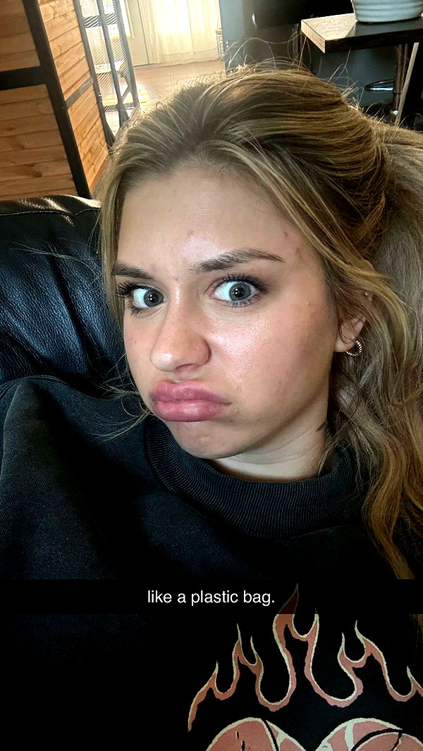 kkierstenking image ~ Altpins