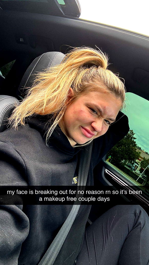 kkierstenking image ~ Altpins