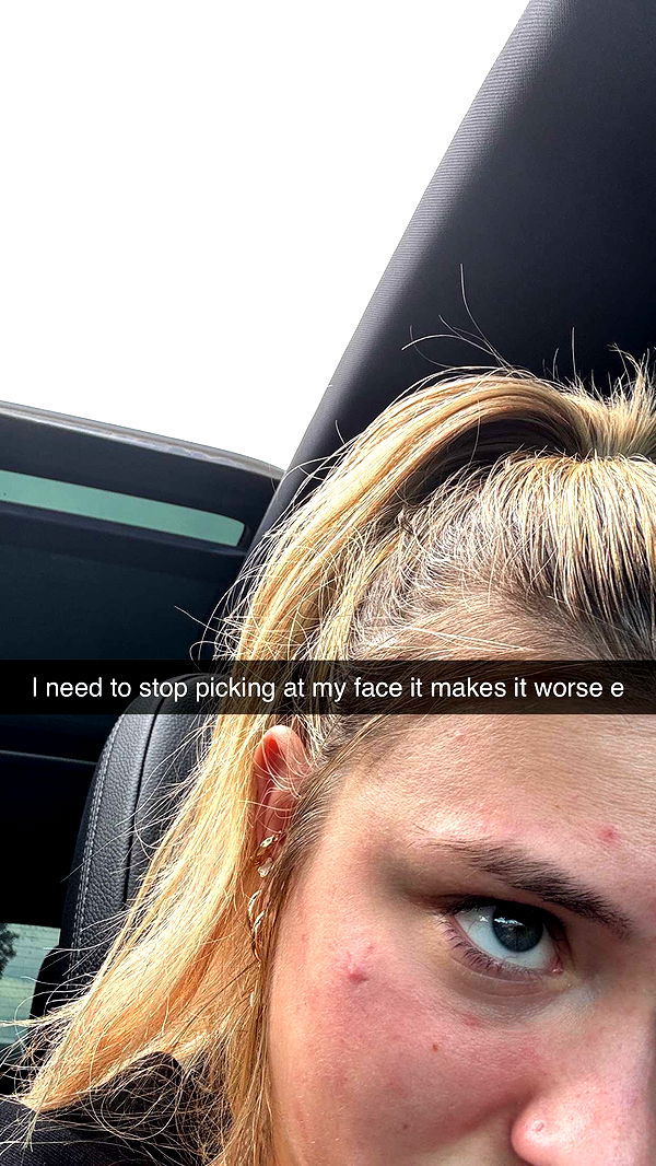 kkierstenking image ~ Altpins