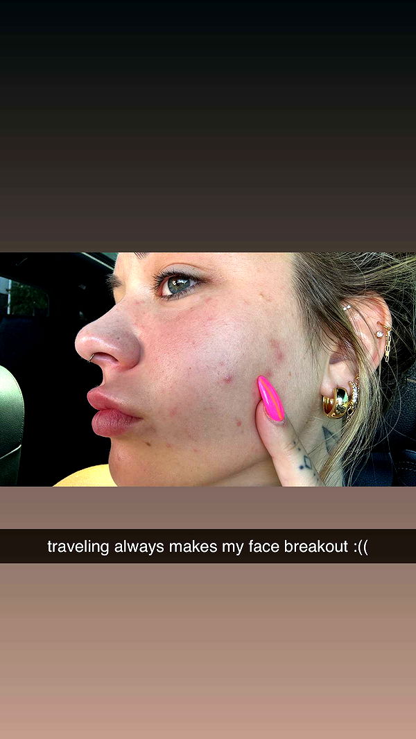 kkierstenking image ~ Altpins