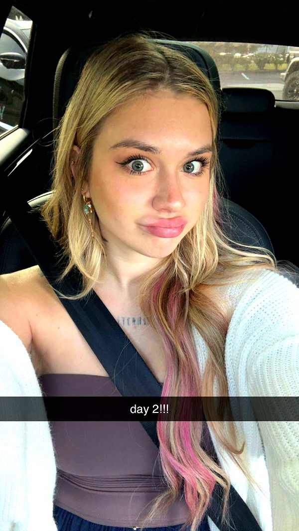 kkierstenking image ~ Altpins