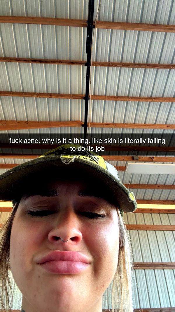 kkierstenking image ~ Altpins