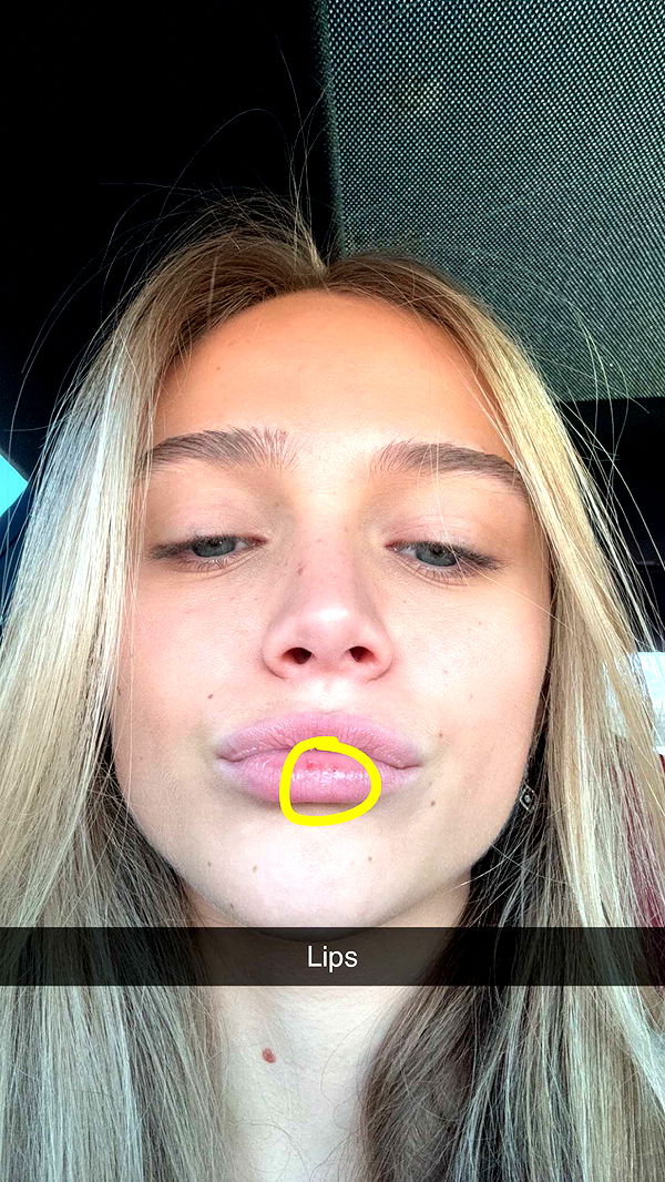 kydoddss image ~ Altpins