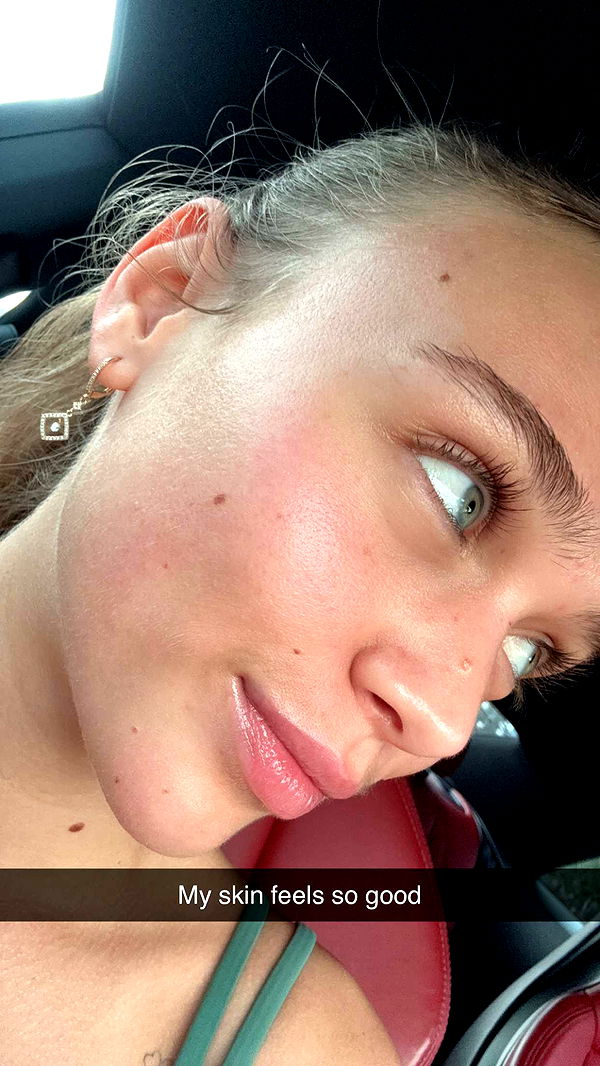 kydoddss image ~ Altpins